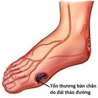 Chế độ ăn phòng tránh bệnh tiểu đường