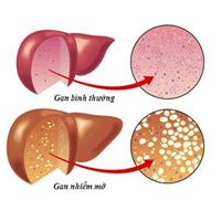 Hạt methi Ấn Độ tốt cho bệnh gan nhiễm mỡ