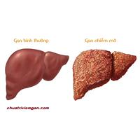 Hạt methi có tác dụng ra sao đối với bệnh gan nhiễm mỡ